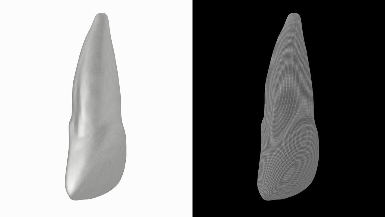 Human Upper Left Central Incisor Tooth 3D Model