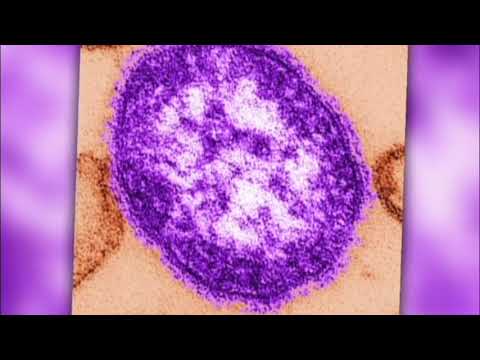 Measles Outbreak Over