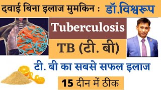Tuberculosis TB | मुश्किल नहीं है टीबी से मुक्ति, घर बैठे कर सकते हैं इलाज|biswaroop roy choudhary