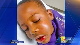 Teacher Breaks Jaw Of ‘Disruptive’ 7-Year-Old Student