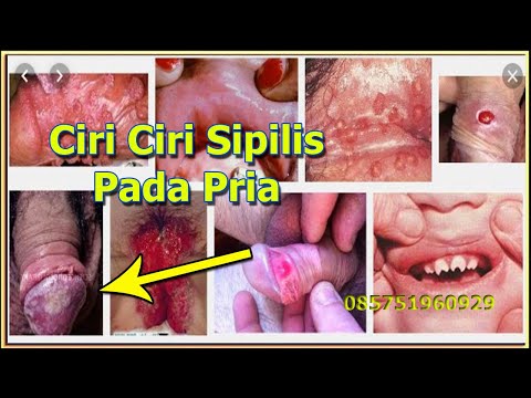 Seseorang memperbesar penis Anda Meningkatkan kondom kontol