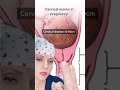 Cervical Exams Explained