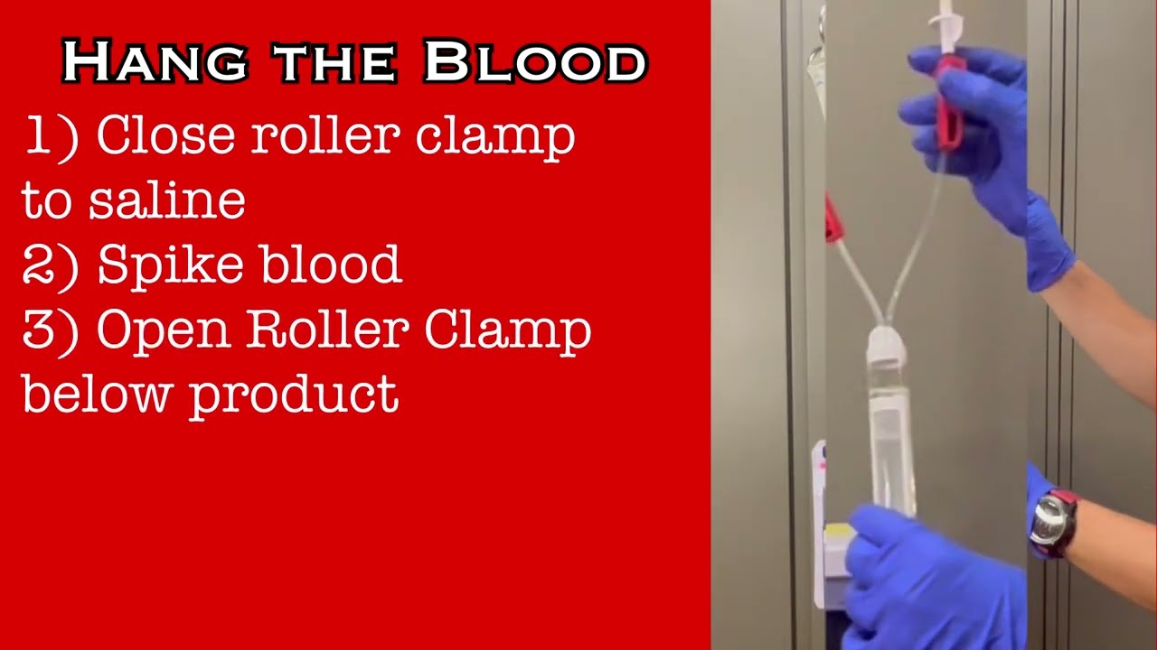 Blood transfusion: Setup and Transfusion (Primary Y Type Tubing)