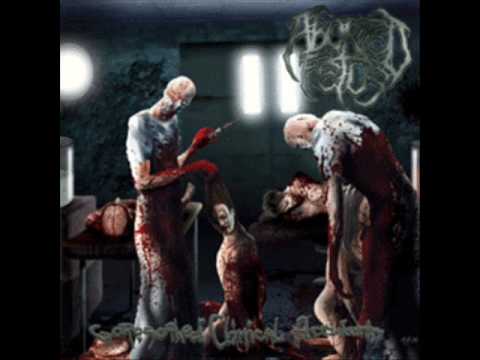 Aborted Fetus - Goresoaked Clinical Accident online metal music video by ABORTED FETUS