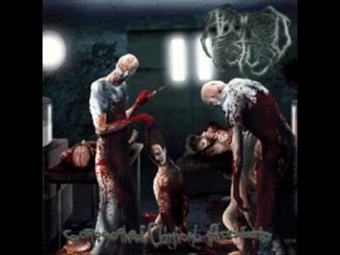 Aborted Fetus - Goresoaked Clinical Accident