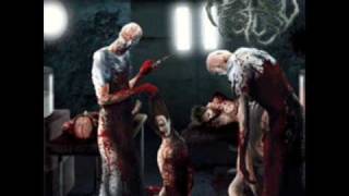 Aborted Fetus - Goresoaked Clinical Accident