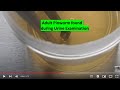 Adult Pinworm Found During Urine Examination