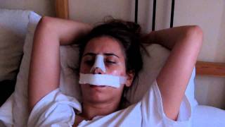 Revision Rhinoplasty Recovery: #1