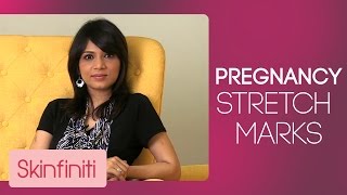 How To Get Rid Off Pregnancy Stretch Marks | Skincare | Skinfiniti With Dr.Jaishree Sharad