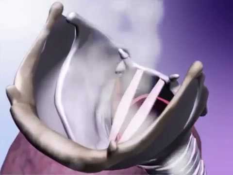 Learn@Visible Body - Function of the Larynx - Phonation