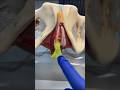 TYPES OF VAGINAL DISCHARGE #mbbs #anatomy #futuredoctor #doctor