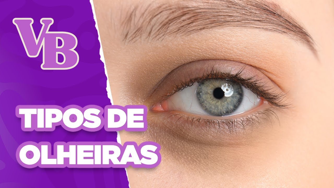 OLHEIRAS: Tipos e tratamentos - Você Bonita (29/11/2024)