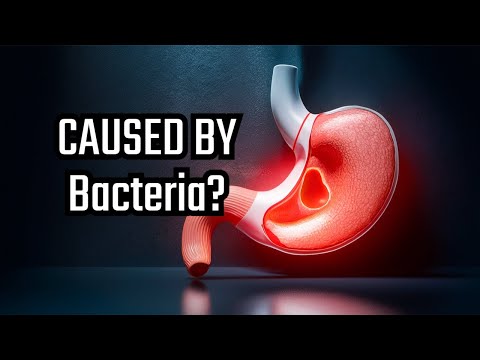 The Surprising Cause of Stomach Ulcers