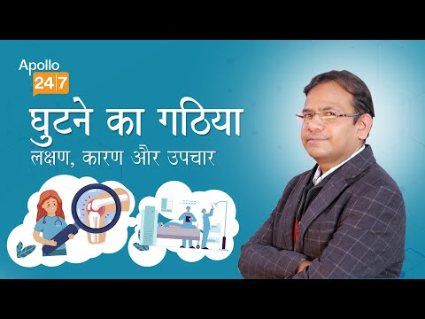 Is Wearing Heels Harmful For Joints Dr Manabendra Nath Basu Mallick