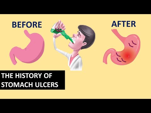 How the Cause of Stomach Ulcers Was Discovered