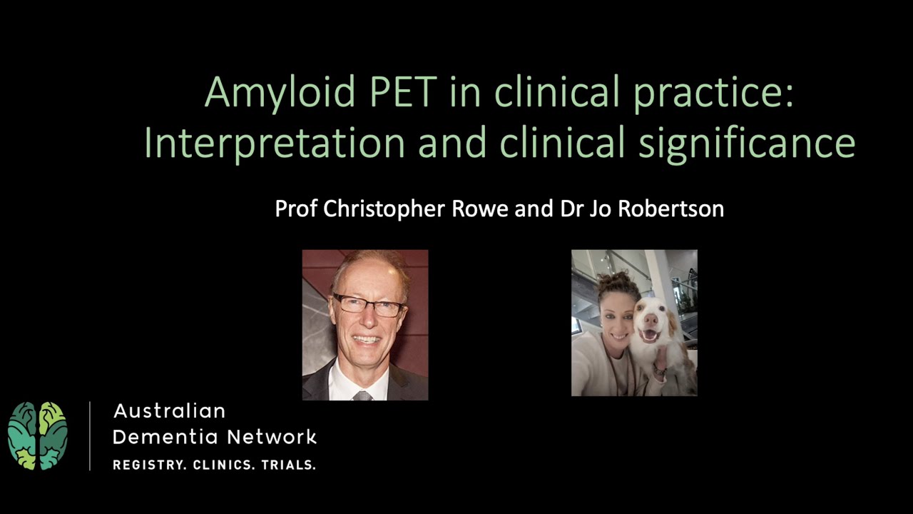 Webinar | Amyloid PET in clinical practice: Interpretation and clinical significance