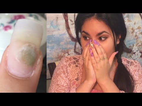 Epektibong ahente para fungus binti Halamang-singaw sa iyong toes ng droga