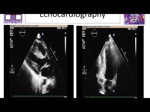 download lagu mp3 mp4 Dr Yatin Gadgil, download lagu Dr Yatin Gadgil gratis, unduh video klip Dr Yatin Gadgil