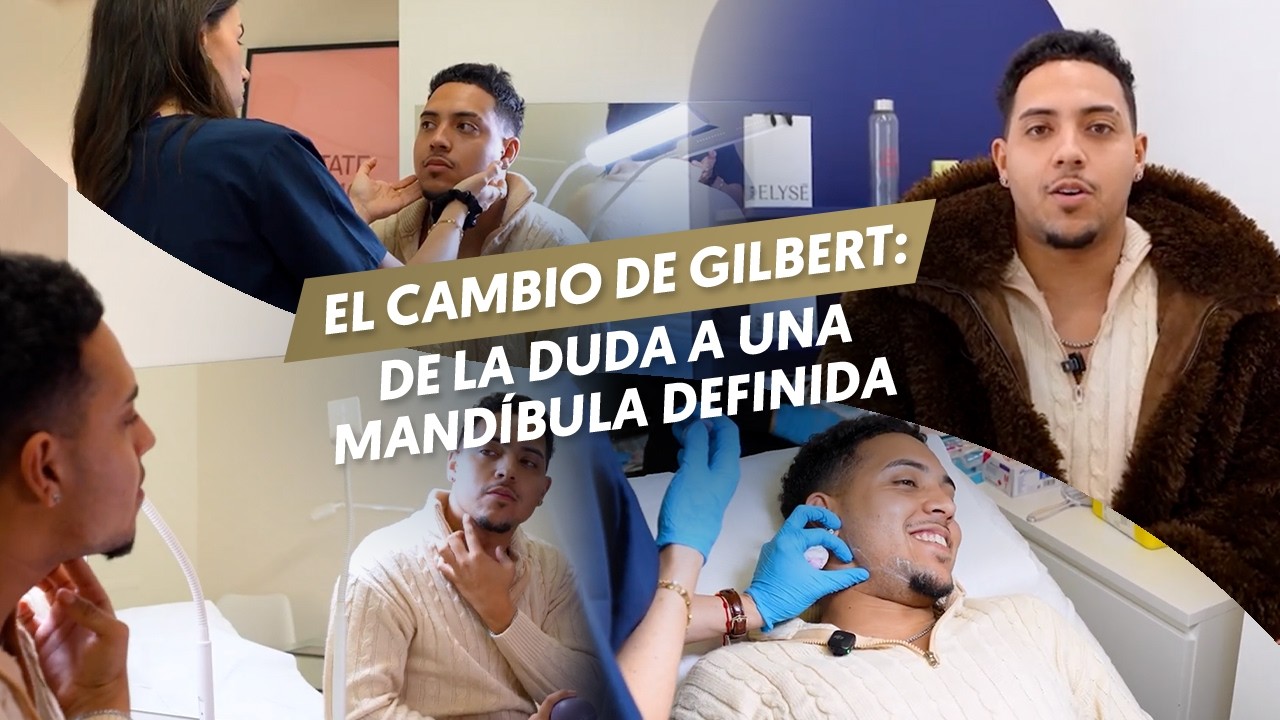 Cargar vídeo: 