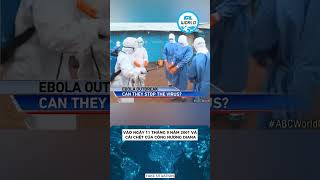 Shocked by Vanga's prophecies for 2025: human organ cultivation in laboratories will be done #shorts