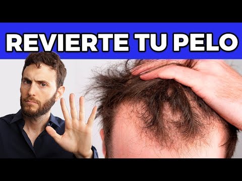 Una Guía Simple para Frenar Tu CAÍDA de Cabello