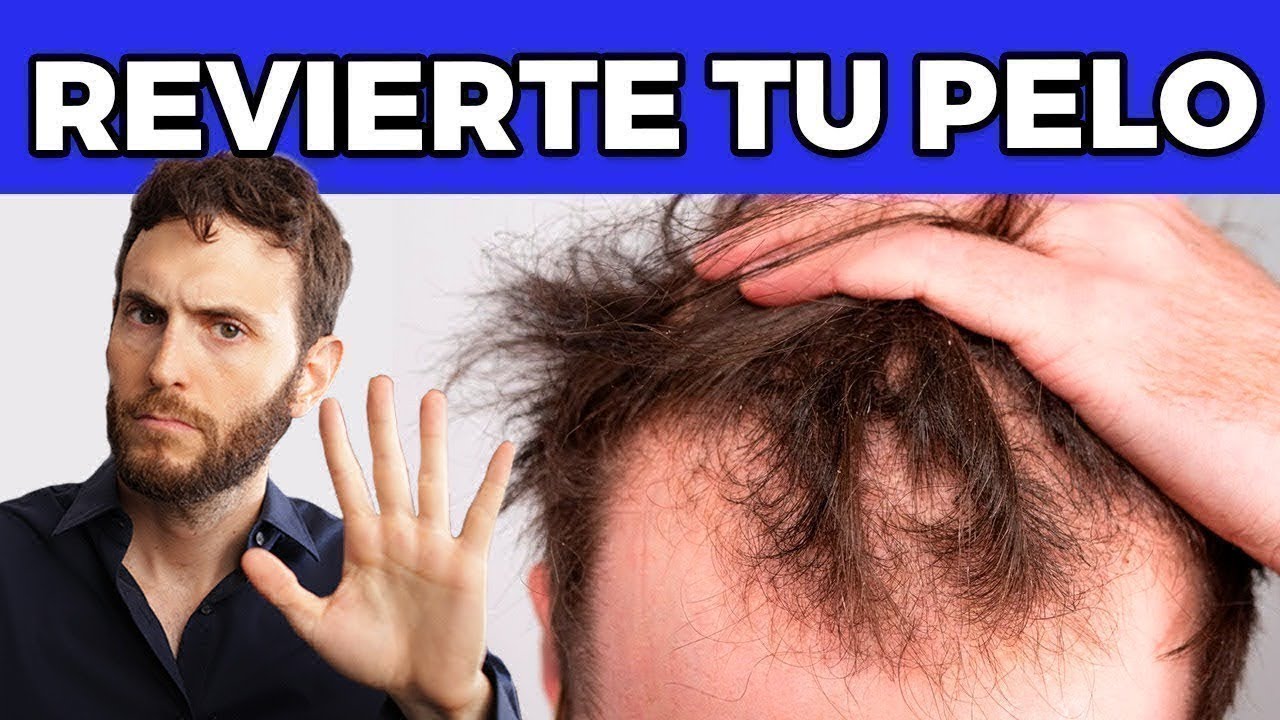 Una Guía Simple para Frenar Tu CAÍDA de Cabello