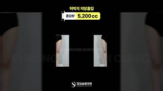 허벅지 틈 사이로 여름이 보여요.