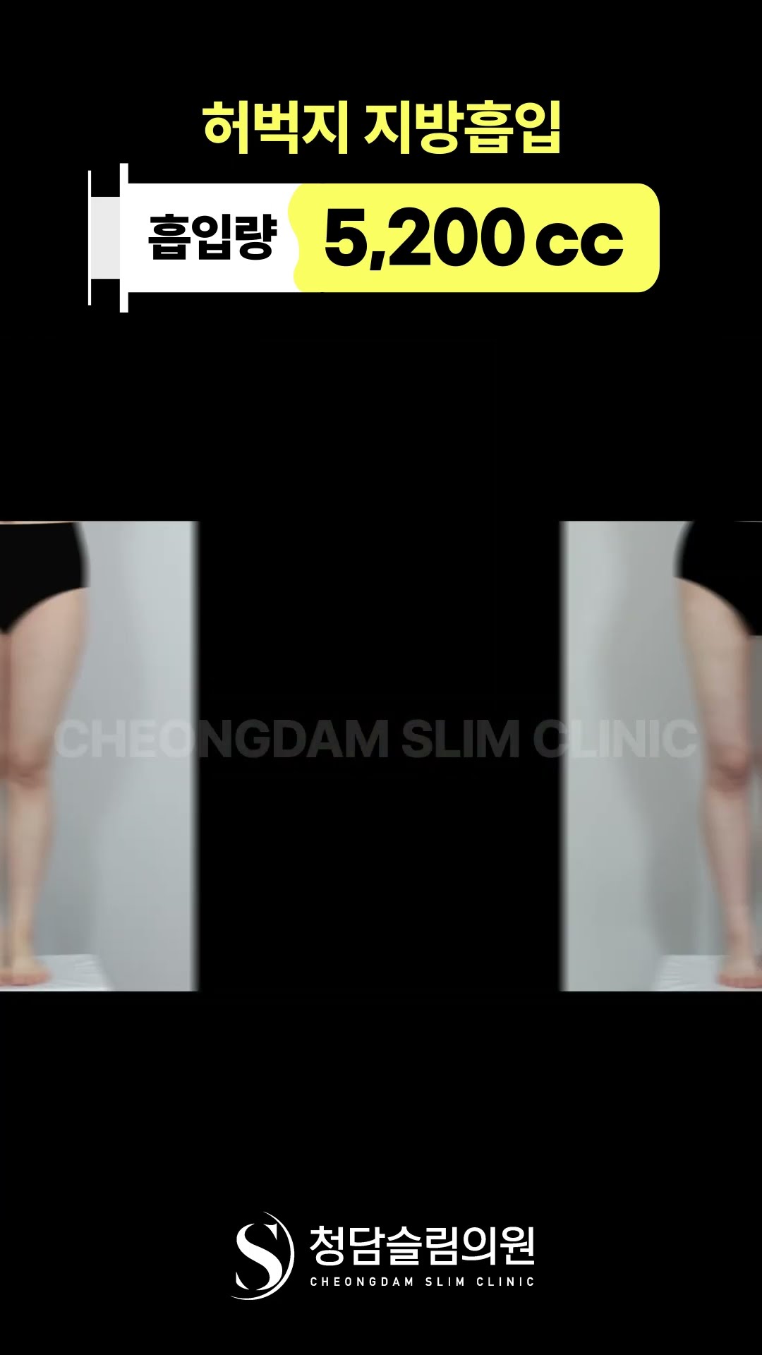허벅지 틈 사이로 여름이 보여요.