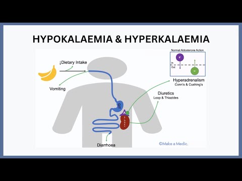Hypokalaemia and Hyperkalaemia Explained