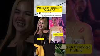 Download lagu Oplas berhasil jadi mirip artis Thailand Icha chellow  #ichacellow #ichachellow #shortvideo #shorts mp3