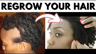 How To Regrow Your Hair - Alopecia & Damaged Hair