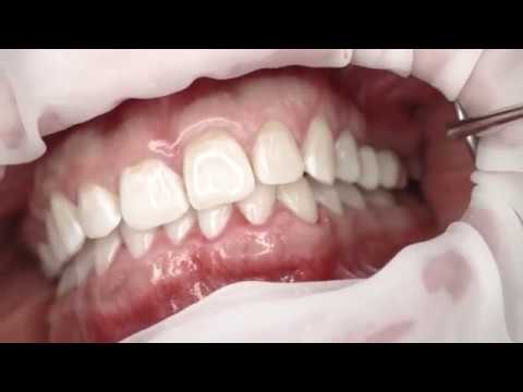 Integrated implantology: The digital workflow.