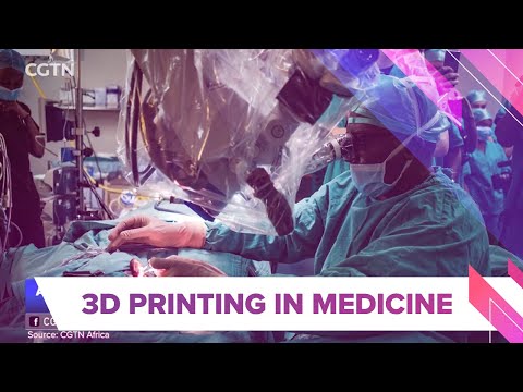 3D Printing in Medicine - Tshifularo transplanted 3d printed earbones