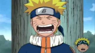 Kakashi isn&#39;t David Bowie