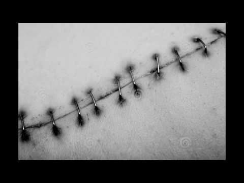 Roda 340 - Cicatrices (ft. Sevy RK)