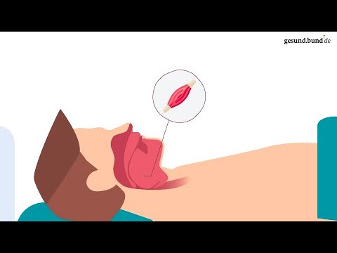 Was ist eine obstruktive Schlafapnoe?