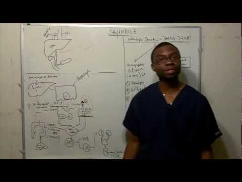 Bilirubin Metabolism- Jaundice(best way to learn in HD)