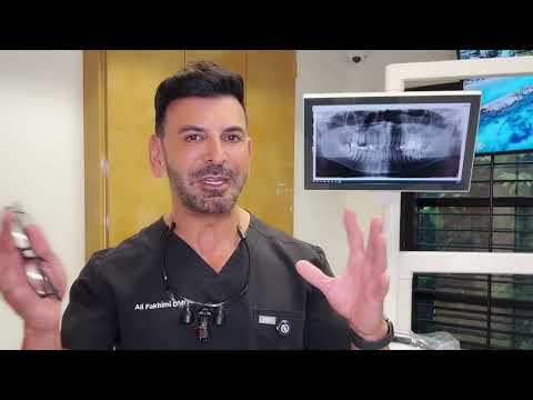 Why You Should Remove Wisdom Teeth Early: Expert Advice from Dr. Fakhimi