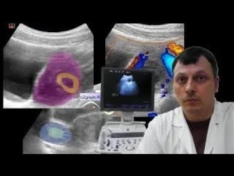 Pediatric Female pelvic ultrasound - Such different ovaries