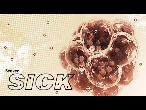 この薬剤耐性菌は、今すぐあなたの脇の下に潜んでいるかもしれません。 (This Drug-Resistant Bacteria Could Be Hiding in Your Armpits Right Now)