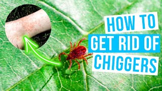 How to GET RID OF CHIGGERS in home and yard