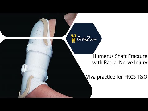 Humerus Shaft Fracture with radial nerve palsy - Viva practice for FRCS T&O