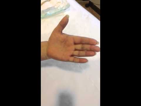Ota per le articolazioni Mal di collo dito intorpidito sulla tua mano