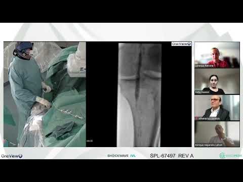 IVL & @vascupedia3776 Shockweek Day 2: Changing the Parameters in Calcified CLTI Treatment
