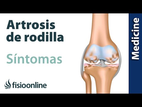 Te Mostramos Cómo Minimizar Los Síntomas De La Artrosis De Rodilla