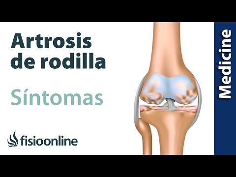 Arthrosis okai és kezelése 1 fok - a betegség tág mérete, 1. fokú deformáló artrózis kezelése