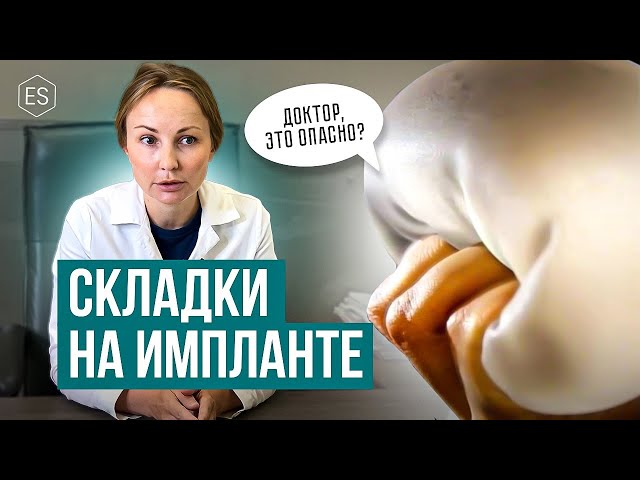 СКЛАДКИ на импланте. Опасно ли это и что делать? Совет пластического хирурга. — Елена Сухопарова.