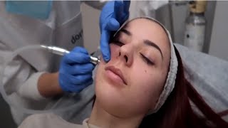 MI experiencia LIMPIEZA facial CON punta DE diamante EN clínica DORSIA💎!!
