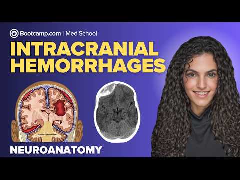 Intracranial Hemorrhage Overview | Epidural, Subdural, Subarachnoid & Intracerebral hemorrhage