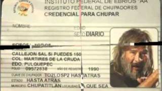 HOMBRES G ME DUELE LA CARA DE SER TAN GUAPO